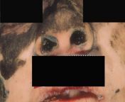 Soot within the nostrils of a fire victim, indicating that he was likely breathing during the fire. from free​fire​