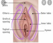 Has anyone else had or have Outside vaginal soreness on the labia (outside labia / labia majora) after laparoscopic excision surgery? from tamil labia