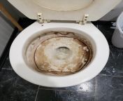 Is this toilet salvageable? My normal gel toilet bowl cleaner and brush won&#39;t make a dent in the stains from thamanna xxxxetty is pissing toilet