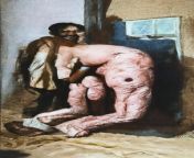 Naked man with leprosy masturbates with his large penis from emo stickam teen masturbates with vibratorran xv