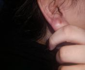 what is this lump on my ear? it&#39;s painful to touch and out of that it comes some liquid like water?? should i be worried? i recently had closed ear. from lump com