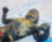 Journalist Hossam Shabat publishes an image, which he previously took at the Indonesian Hospital. The image shows a child burned by Israeli missiles, seemingly screaming in agony. from jpg4 image