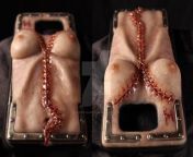 This female autopsy phone case from new female autopsy of woman