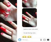 A girl on Instagram told me she has blood problems and was bleeding from nails. Idk. why is her blood pink? from girl xxx blood sex videos ामुक हुई 6 साल की लड़की पेशाब का बहाना बनाकà