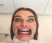 Brooke Shields at the dentist from fake brooke shields