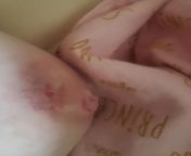 This is a bit gross but im worried and a first time mom my baby is almost 2 weeks and latches but its painful as hell, i got to ask has this happened to anyone else? Is it normal? from beautiful breastfeeding mom breastfeeding baby breastfeeding baby drinking breast milk