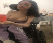 Would you fuck a tiny disabled girl who is obsessed with sex? from mentally disabled girl sex