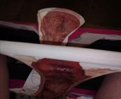 Free bleeding through a pair of pants onto a pad. These were soooo messy and smelly. I wore them for 3 days and even pissed through them ?? A very lucky man has already got dibs on these though. from nusrat xxx downloadold man xxx 16 age girl aunty real sex kannada