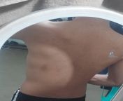 Why is my back darker than my front(chest, abdominal area) when it&#39;s covered by clothing all the time?,I noticed also that my feet are darker than the rest of my body. from abdominal