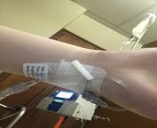 This is my second time at the hospital because of lupus... lupus made a blood clot on my right leg and now i&#39;m in the hospital, really tired of needles ... from beby hospital delevary made