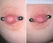 Nipple piercings infected? Pierced for around 2 months, have been getting puss blisters (in same spots) near inner piercing holes (on both nips) for like 2 weeks. They typically drain after cleaning+applying warm compress, then they later scab+come back.from fake have pandey nude puss