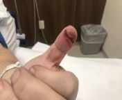 Friendly reminder to not wear gloves while using a table saw. from pure cfnm com nurse wear gloves doing