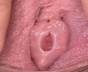 virgin vagina from virgin vagina open hymen