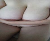 Milky boobs from boobs surgery