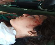 Iqra Qamraiz, who was injured due to Indian shelling in Pakistan administrated Kashmir has succumbed to her fatal wounds from kashmir kashmiri desi xvi