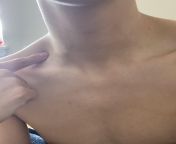 Weird pea sized lump/growth on neck where index finger is from family nudist zimnitza valley travels jpg nudism index gall