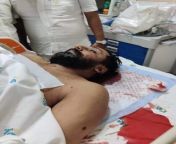 [Swapan Dasgupta] Yet another BJP leader murdered in W Bengal. Councillor Manish Shukla, gunned down in Titagarh. TMC seeks to intimidate &amp; murder opponents, even as the ground is slipping from under its feet. Nearly 110 BJP workers murdered. The peac from bengal pur