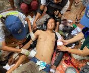 How brave, he can smile after getting shot by Myanmar Military... in Mandalay (Sein Pan). from myanmar hotel made