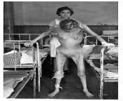 [NSFW] Margit Schwartz, age 31, a survivor of Bergen-Belsen concentration camp, pictured in the hospital soon after liberation. April 1945. [19222747] from koko margit