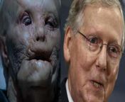 In Hannibal (2001) they not only based the looks but also the personality of Mason Verger on Mitch McConnell. from mitch