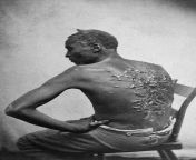 A former slave named Gordon shows his whipping scars. Baton Rouge, Louisiana, 1863. from slave passes out during brutal whipping
