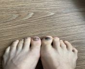 Any tips on how to prevent this from happening ? Both happened when I forgot to clip my toe-nails very short - so of course Im taking care of that now. But any other tips ? And how should I take care of them as they start to come off? Thanks for any tips from hindustan sleeping mom to nigt beedroo son sex mom real