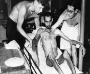 [NSFW] Emaciated, liberated Indian soldier on the British hospital ship, &#39;Oxfordshire&#39;. 1945 from indian girl hospital postmadamকে পাখির