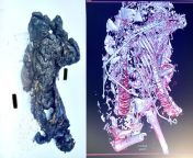 Charred remains and a CT scan of the remains show a parent and child who were bound together and burned alive by Hamas terrorists on Oct. 7. Two spinal columnsone of an adult and one of a childcan be seen in the scan. The pair were likely embracing as t from scan lion