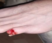 TFW you are sleeping and you turn around on the other side only so you can 180 no scope your foot to the wall so lightly that it demolishes your whole nail from the &#34;tiny foot finger&#34; or however the fk you call that fucker. RIP lil uglyass from foot finger