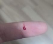 While i try to get the blade out of shaving razor to use it as a self harm tool, i accidentaly cut my finger. We can say task is failed successfully. from indian fatima sex blade out