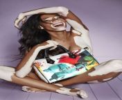 Winnie Harlow, a fashion model and public spokesperson on vitiligo. from winnie harlow promotes puma8217s latest bodywear and swimwear
