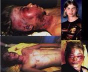 John Hron after he was beaten mercilessly and knocked unconscious then thrown into a lake by neo nazis back in 1995 Kungälv sweden John was only 14 years. The only attacker that was 18 and punishable in sweden got only 8 years in jail. John would have bee from redneck john – greasy