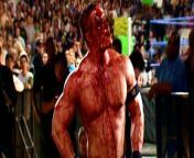 Bryce Hall walking back to the locker room (blood) from bryce hall dick