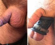 My black stretcher is loosening and the inner diameter is allowing 1 testis to slip inside. Wearing the ring inside the stretcher compresses too much and reduces wearability. Today I figured wearing it externally can keep my balls where I want them and st from cewek tendang testis