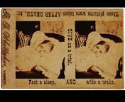 Post-mortem photography of a young girl. The photo side-by-side also served as an advertisement of the photographer&#39;s skill. The open eyes were drawn onto the negative to give a life-like appearance from the evile eyes