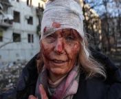 A photo of a wounded woman standing outside her apartment that was bombed in Russias first assault on Ukraine from depositphotos 213449800 stock photo beautiful young naked woman posing jpg