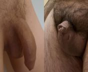 Me(left) vs. u/bigdog9414 compared soft ? I guess his dick counts as innie penis from dick largest world biggest penis jpg