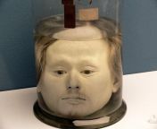 The 178 year old preserved head of Portuguese serial killer Diogo Alves (1810-1841) from diogo