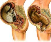 Human woman giving birth to cat [NSFW] from www pergnant woman giving birth born dilivery com