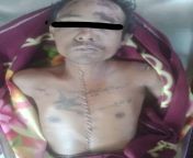 South Dagon. 104 Quarter. Ko Aung Min Thu (Age 37),a father of a son and two daughters. He was shot in the chest and back last night and was dragged away by the junta terrorists. And today,they announced the man&#39;s death and gave his body like this tofrom aung