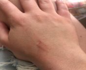 My veins started hurting/ throbbing (no sign of blood or having cut myself), it was just a weird pain. I checked my hand and hour later and where my veins are i started seeing blood? from xxxman and hour
