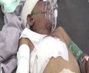 Hajjah Governorate: An 11-year-old child was injured, yesterday evening, Thursday, as a result of the explosion of a cluster bomb left behind by the Saudi-led coalition in the Azman border area. from thia azman bokep