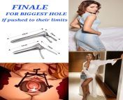 FINALE ROUND = speculum . The size of the speculum will keep on increasing till one of them Taps out [Task-both of them starts from 5inch width] pick your winner and if possible tell how many inches she can spread. from width