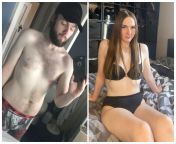 Its Crazy how much estrogen can change your body, Im sitting at home recovering from my first surgery and looking back Im so happy with what estrogen did for me ?.(25-28, 2 Years HRT) from estrogen entertainment