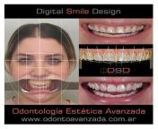 www.odontoavanzada.com.ar dentista en La Plata ortodoncia brackets odontologo from www com xx vido lndla la