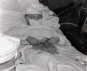27-year-old Soviet doctor, Leonid Rogozov, performing surgery on himself to remove an infected appendix during a 1961 expedition to the Antarctic, where he was the only doctor on the team. from remove an vil