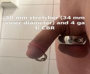 30 mm stretcher and 4 ga PA from 10 age boy 30 age girl sex videolay