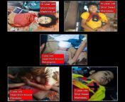 Children are not protesting. Children are not taking to the streets. Children are just playing at home. But, many children are being brutally killed by the junta in Myanmar. Our children are innocent and unarmed like other fallen heroes. r/SaveChildren from myanmar actress leaked