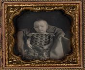 Post-mortem portrait of an infant girl. 1852 from post mortem pregnancy toxemia