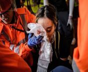 Disturbing image warning: Hong Kong Police shot right in the eye of a female protestor in Tsim Sha Tsui, purely police brutality. #standwithhongkong from kitty sha bogel